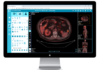 free DICOM viewer on Mac