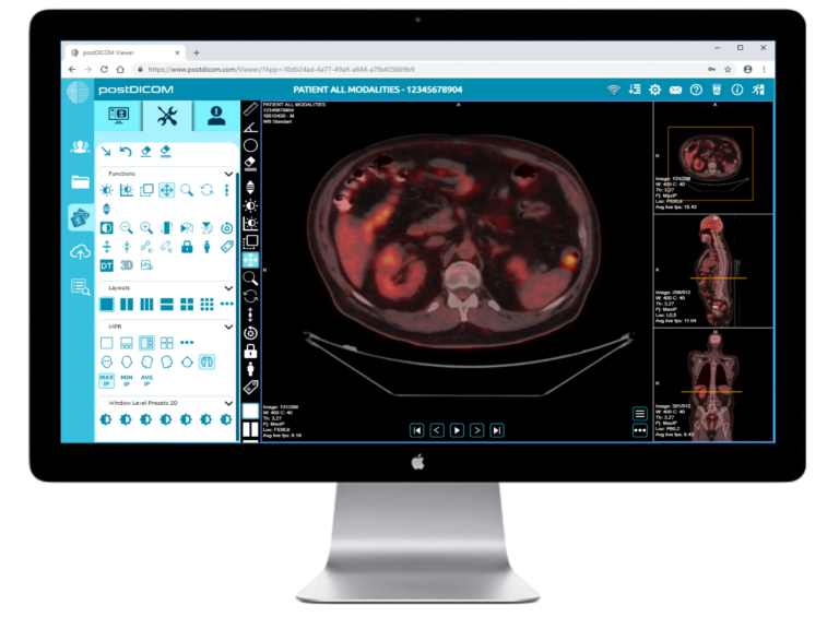 Attention MAC Users: Say Goodbye to Expensive Software with This Free DICOM Viewer Packed with Amazing Features