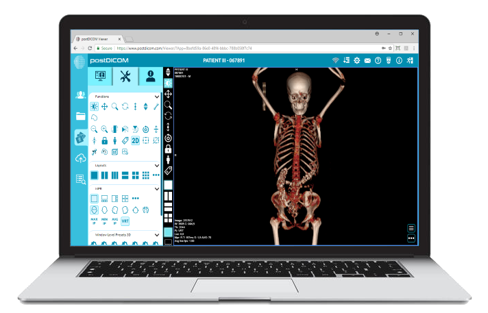 free DICOM viewer on Mac