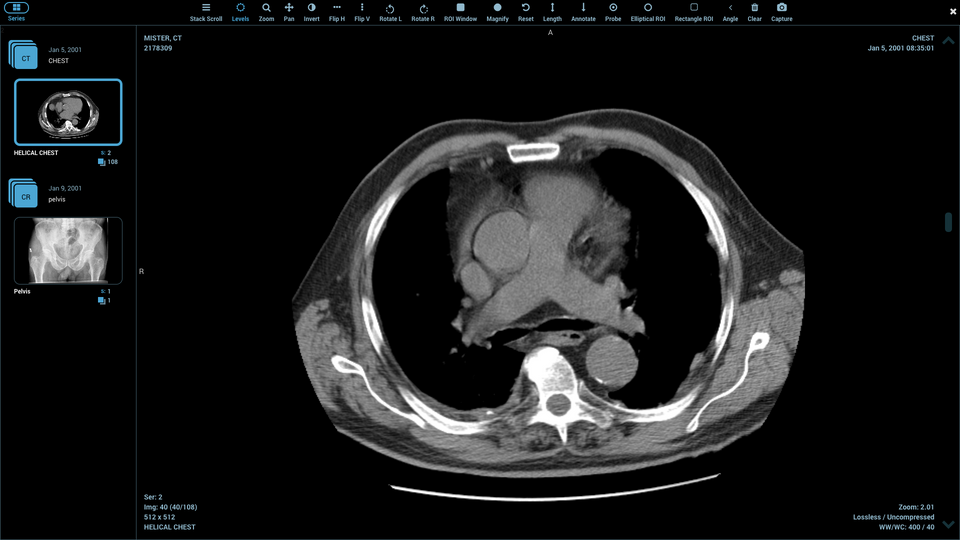 Online DICOM viewer